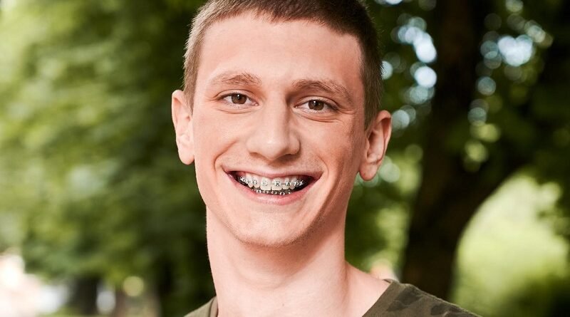 Clear Aligners